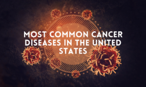 Most common cancer diseases in the United States, both men and females, are often questioned. But there are two possible answers to this question.